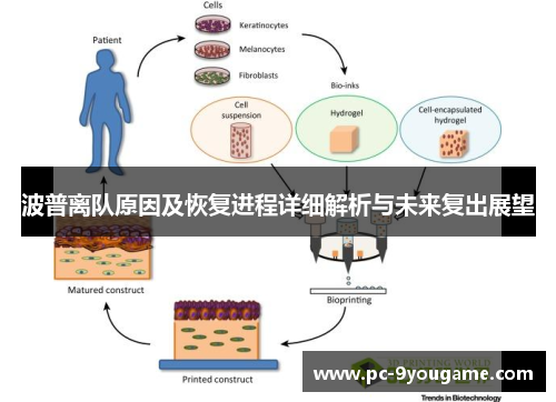 波普离队原因及恢复进程详细解析与未来复出展望